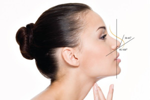 Nên căng da midface trước hay nâng mũi trước? Bác sĩ giải thích theo từng trường hợp