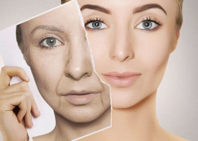 Nên căng da Midface, tiêm filler hay nâng cơ HIFU? Chọn gì cho vùng má giữa bị xệ?