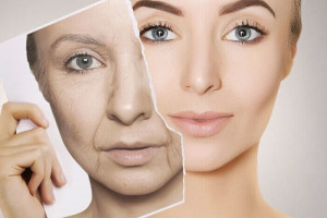 Nên căng da Midface, tiêm filler hay nâng cơ HIFU? Chọn gì cho vùng má giữa bị xệ?