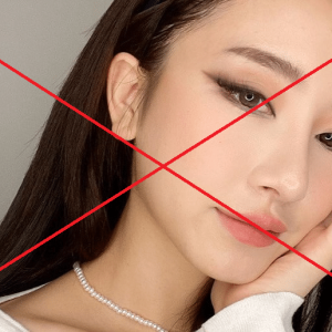 8 trường hợp không nên nâng mũi bạn cần phải biết