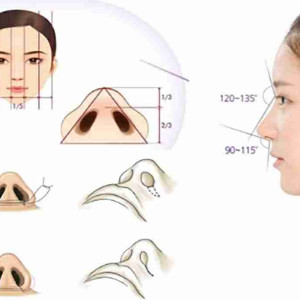 Bác sĩ giải đáp: Cắt cánh mũi có để lại sẹo xấu không?