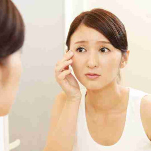  30 tuổi có nên phẫu thuật căng da mặt không?