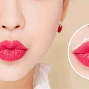 Bác sĩ giải đáp: Cắt môi trái tim bao lâu thì hết sưng đau?