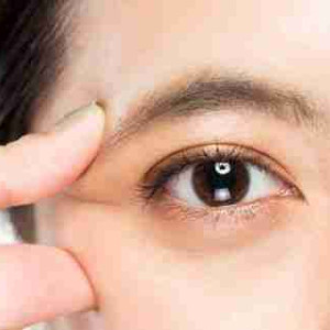 Bạn đã hiểu đúng về phương pháp cắt mí đôi chưa?