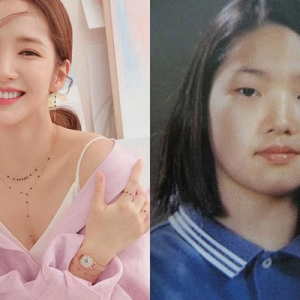 Bác sĩ giải đáp: Cắt mí mắt có được vĩnh viễn không? 