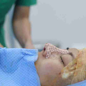 Sửa mũi hỏng nhiều lần có nguy hiểm không?