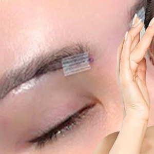 Treo cung chân mày – Giải pháp cho đôi mắt trẻ trung, to tròn