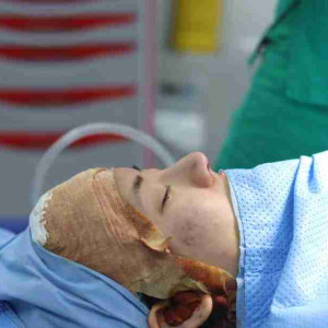 5 nguyên nhân gây mũi lộ sống? Làm sao để khắc phục?