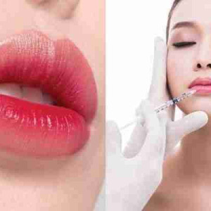 Tiêm môi trái tim cần lưu ý gì?