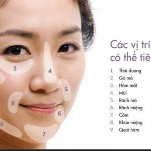 Bao lâu thấy hiệu quả khi tiêm filler tạo hình khuôn mặt?