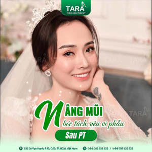 Nâng mũi siêu vi phẫu khắc phục mũi gồ để cao, đẹp hơn