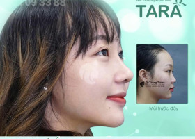 Kinh nghiệm chọn bác sĩ nâng mũi siêu vi phẫu giỏi tại TP.HCM