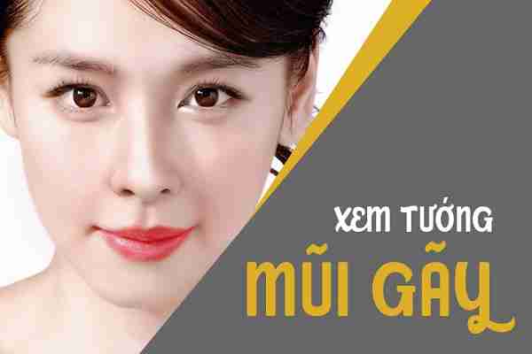 Xem tướng mũi gãy và những kết quả bất ngờ