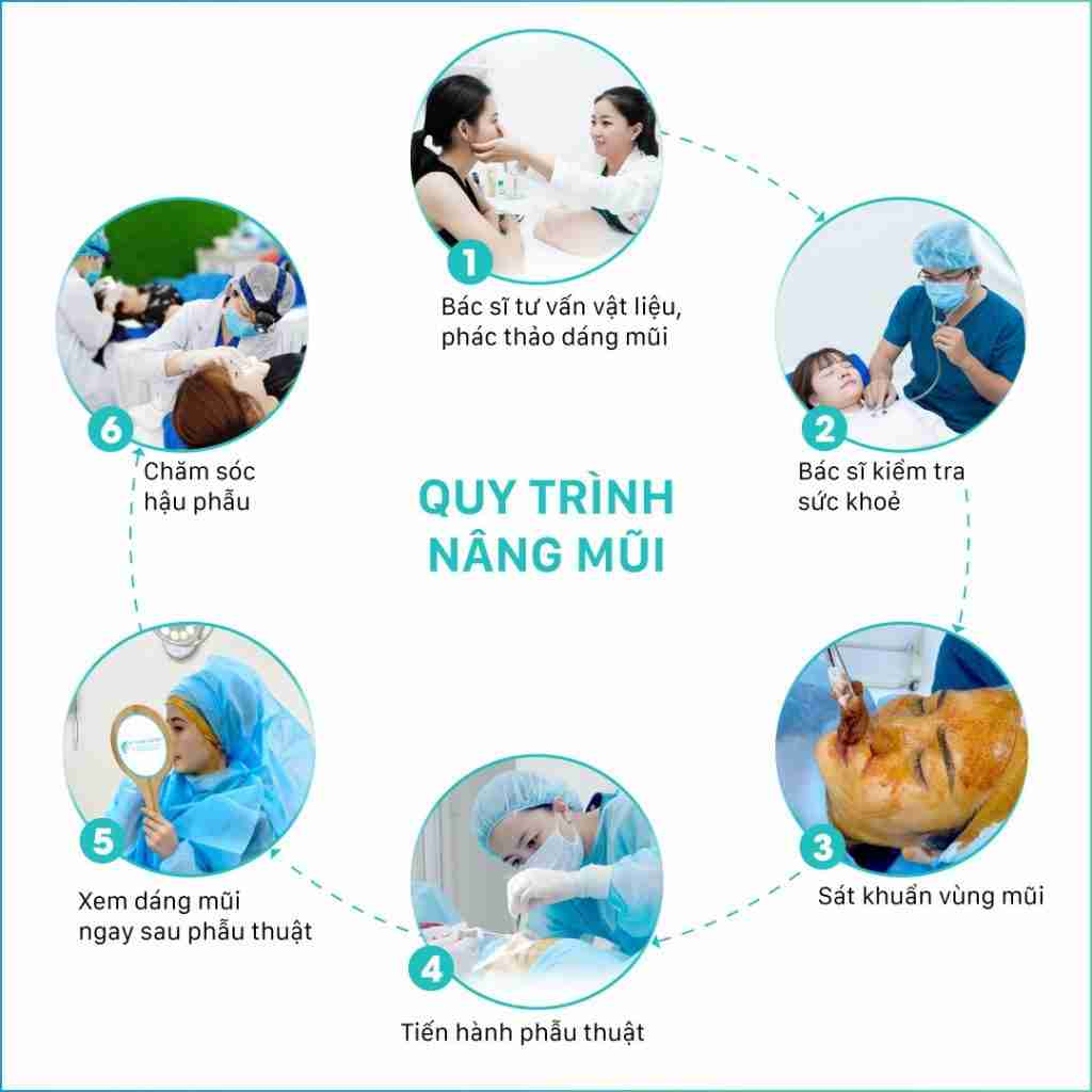 quy trình nâng mũi tại tara beauty clinic