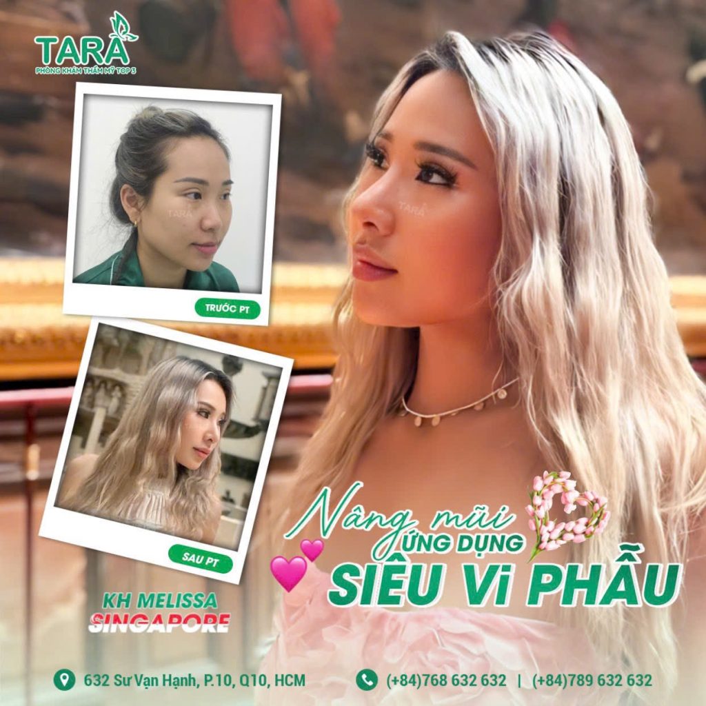 Review nâng mũi Bác sĩ Trang khách hàng từ Singapore