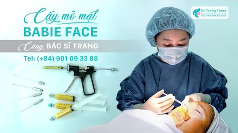 Bác sĩ giải đáp: Cấy mỡ mặt Babyface có bền không?