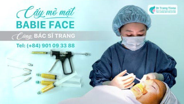 Cấy mỡ mặt babyface có nguy hiểm không?