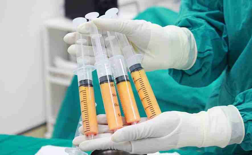 Cấy mỡ mặt khi mới tiêm filler có sao không?