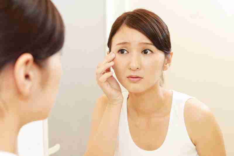 30 tuổi có nên phẫu thuật căng da mặt không?