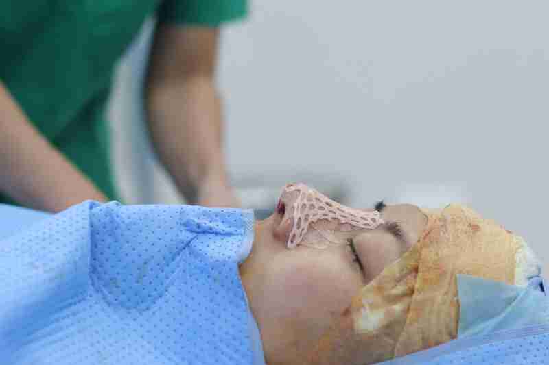Sửa mũi hỏng nhiều lần có nguy hiểm không?