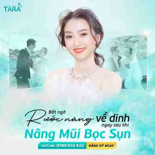 Nâng mũi bọc sụn ERAS 5i