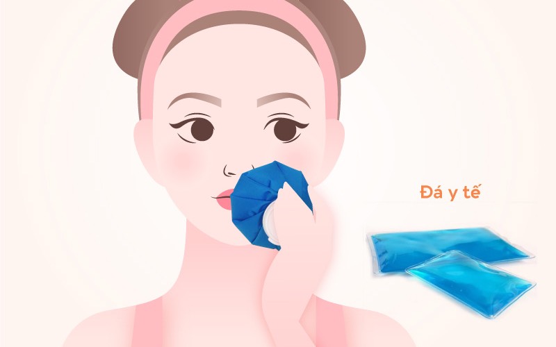 Cách giảm sưng sau khi cấy mỡ trẻ hóa da?
