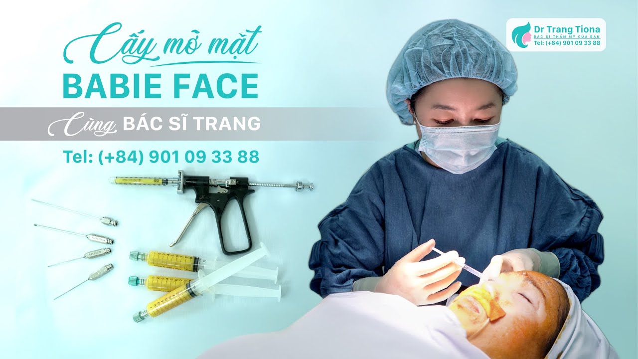 Cấy mỡ mặt babyface trẻ hoá và hệ luỵ từ biến chứng