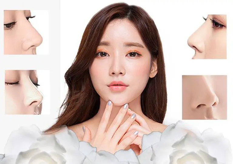 Căng da Midface xong có nâng mũi ngay được không?
