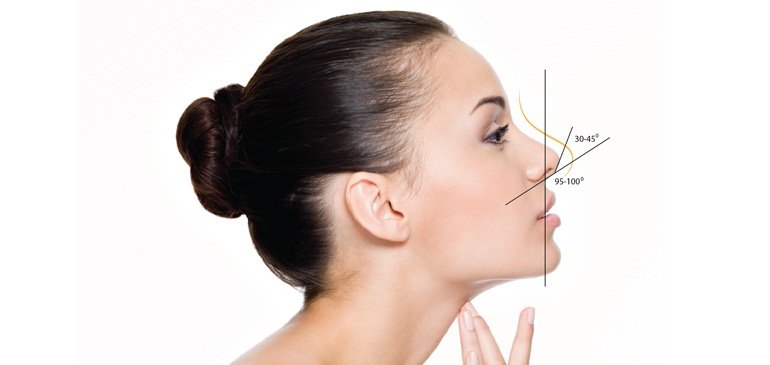 Hiểu về mũi siêu vi phẫu không đau cho người mũi tẹt