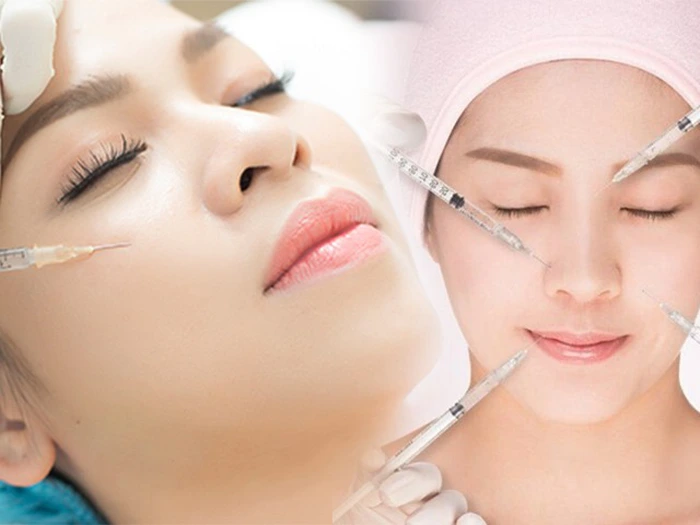 Bảng giá tiêm filler tạo hình khuôn mặt 2025