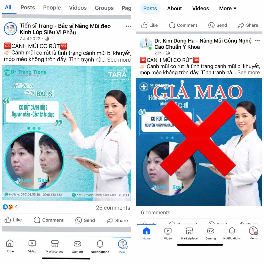 Cảnh báo giả mạo TS.BS Trang về nâng mũi siêu vi phẫu