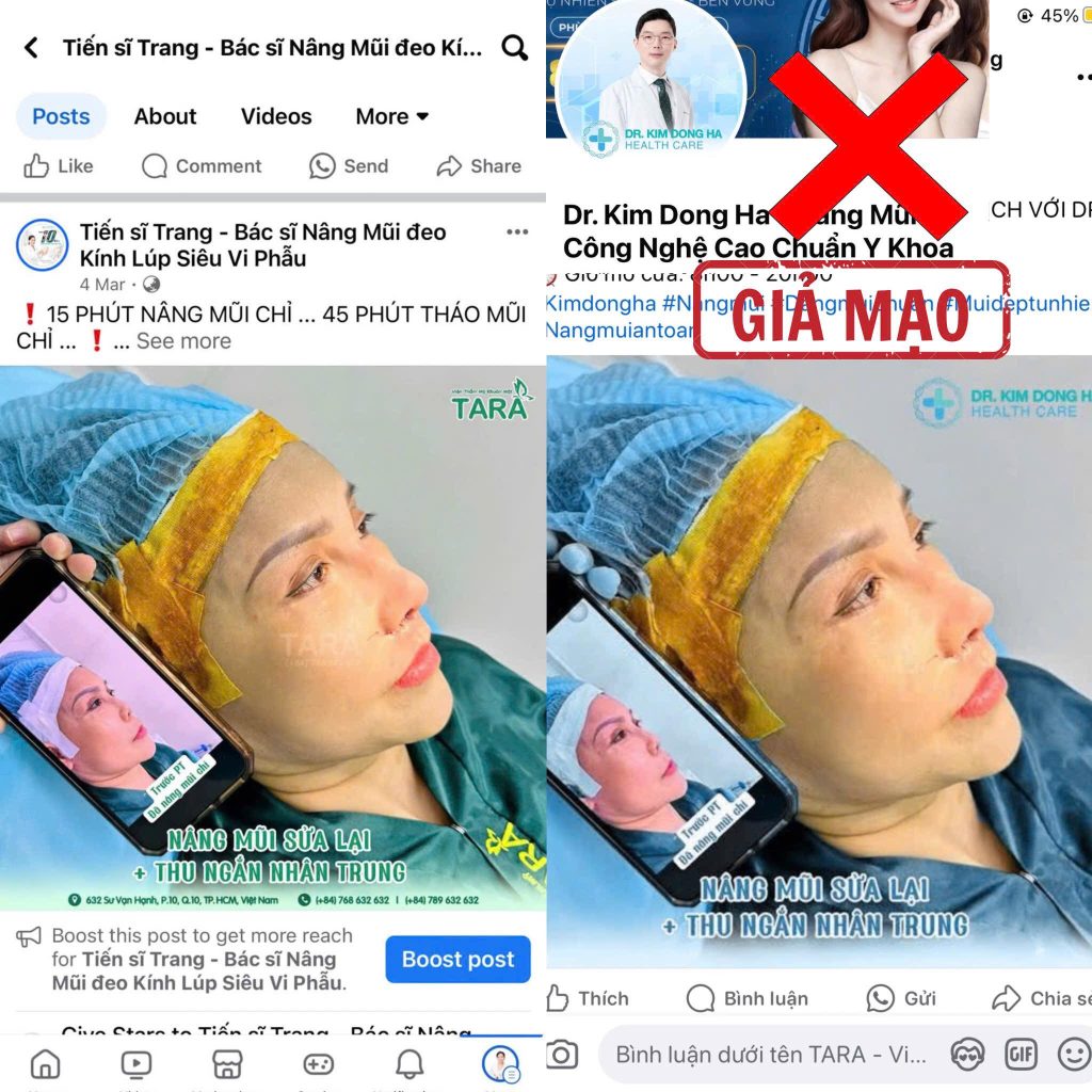 Cảnh báo giả mạo TS.BS Trang về nâng mũi siêu vi phẫu