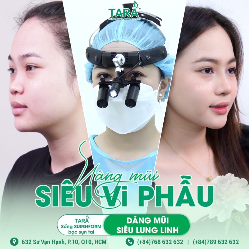 Nâng mũi siêu vi phẫu bằng sụn nhân tạo hiện đang là phương pháp thẩm mỹ được yêu thích bởi tính chính xác, an toàn và hiệu quả cao. Không chỉ giúp cải thiện dáng mũi trở nên hài hòa và tự nhiên, kỹ thuật này còn phù hợp với nhiều tình trạng mũi khác nhau nhờ sự đa dạng trong lựa chọn sụn nhân tạo.
Nếu bạn đang quan tâm đến dịch vụ nâng mũi, bài viết này sẽ cung cấp đầy đủ thông tin từ nâng mũi siêu vi phẫu là gì, các loại sụn nhân tạo phổ biến, đến cách lựa chọn phù hợp với từng dáng mũi.