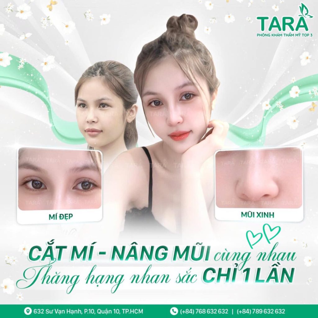 Nâng mũi và cắt mí mắt: bộ đôi hoàn hảo kiến tạo nhan sắc vàng