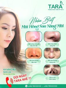 Địa chỉ sửa mũi hỏng siêu vi phẫu bằng trung bì mỡ TPHCM