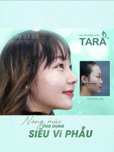 Kinh nghiệm chọn bác sĩ nâng mũi siêu vi phẫu giỏi tại TP.HCM