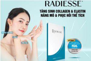 Tiêm Radiesse: Trẻ hóa da bằng cách tự thân sản sinh collagen