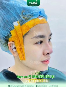 Meta Description: Phân tích chi tiết ý nghĩa tướng số của Mũi Rồng, Mũi Lân, Mũi Két. Giải pháp chỉnh sửa dáng mũi để cân bằng thẩm mỹ và phong thủy bằng Kỹ thuật Siêu Vi Phẫu với TS.BS Cái Hữu Ngọc Thảo Trang.