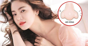 Meta Description: Phân tích chi tiết ý nghĩa tướng số của Mũi Rồng, Mũi Lân, Mũi Két. Giải pháp chỉnh sửa dáng mũi để cân bằng thẩm mỹ và phong thủy bằng Kỹ thuật Siêu Vi Phẫu với TS.BS Cái Hữu Ngọc Thảo Trang.