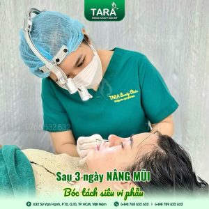 Toàn tập về nâng mũi (A-Z): So sánh các phương pháp và tại sao Siêu Vi Phẫu là xu hướng 2026