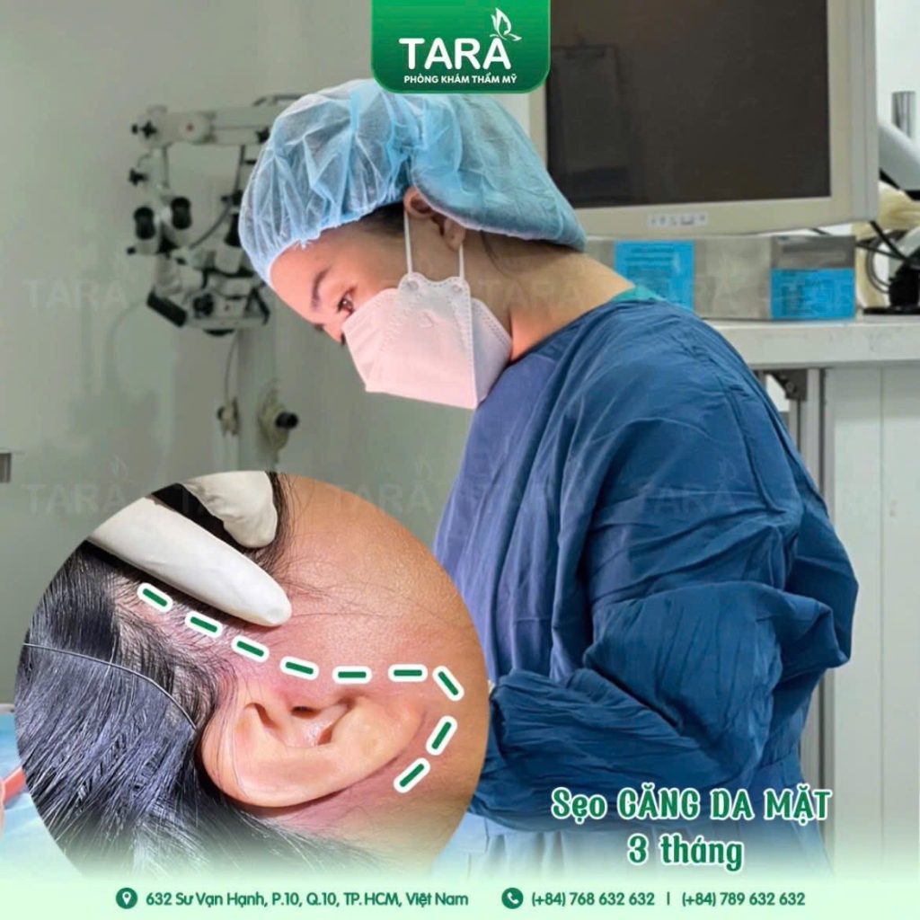 Địa chỉ căng da mặt đẹp uy tín tại Sài Gòn (TPHCM): Tại sao nên chọn TS.BS Trang TARA?