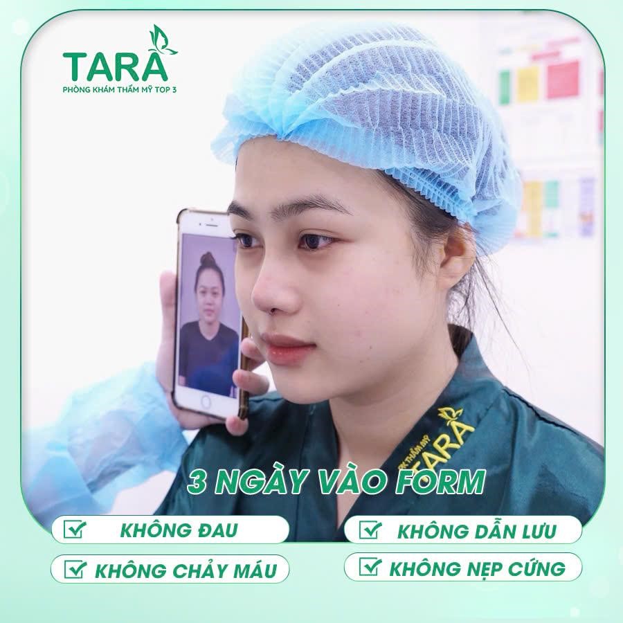 Người bị viêm xoang, huyết áp, tiểu đường có nâng mũi được không?