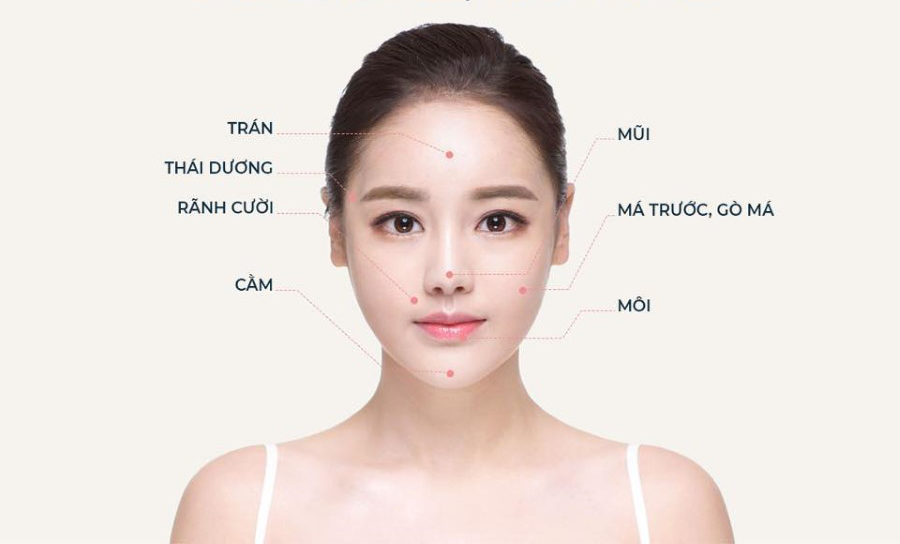 Tiêm fullface trước Tết: nên làm trước bao lâu để tự tin đi chơi?