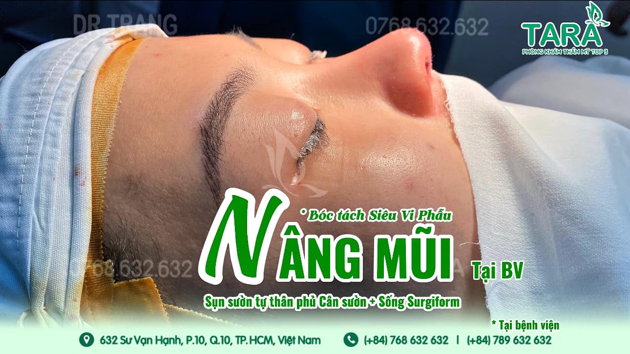 Nâng mũi không nẹp có đau không? Thực tế cảm nhận khách sau 1- 7 ngày