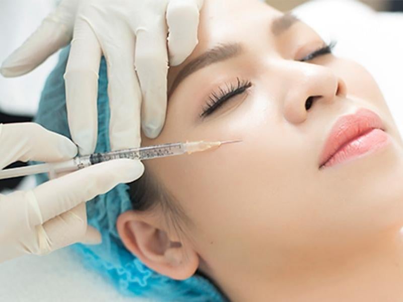 Cấy mỡ mặt vs filler: cái nào hợp với người trên 35 tuổi?