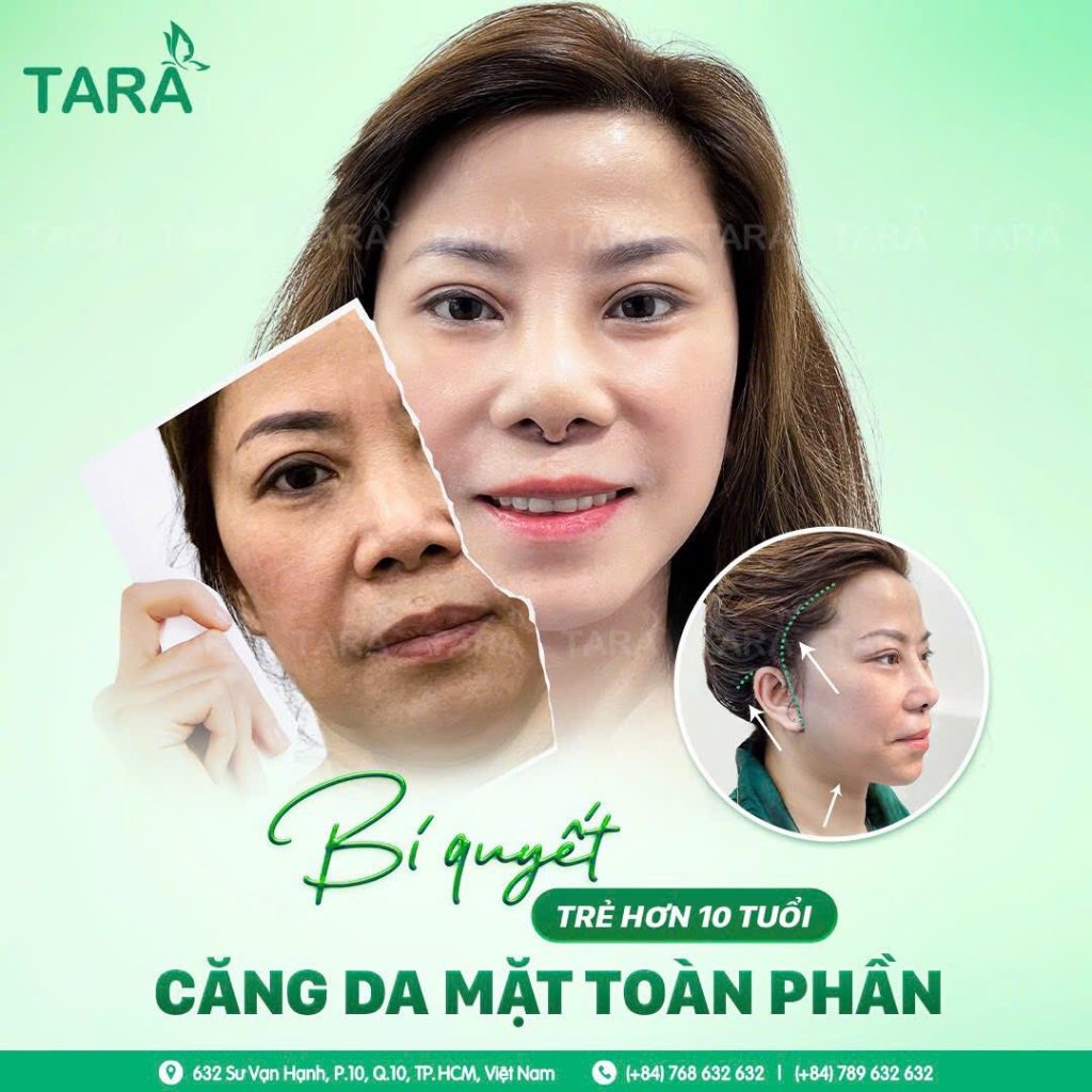 Căng da mặt đẹp tại TP.HCM giá bao nhiêu? Tham khảo chi phí & lộ trình tại TARA Beauty