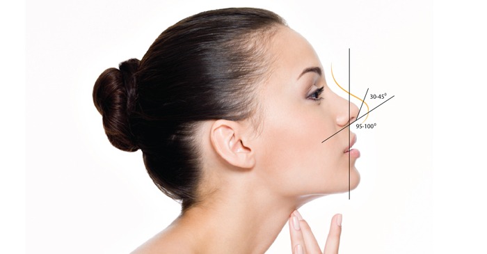 Nên căng da midface trước hay nâng mũi trước? Bác sĩ giải thích theo từng trường hợp