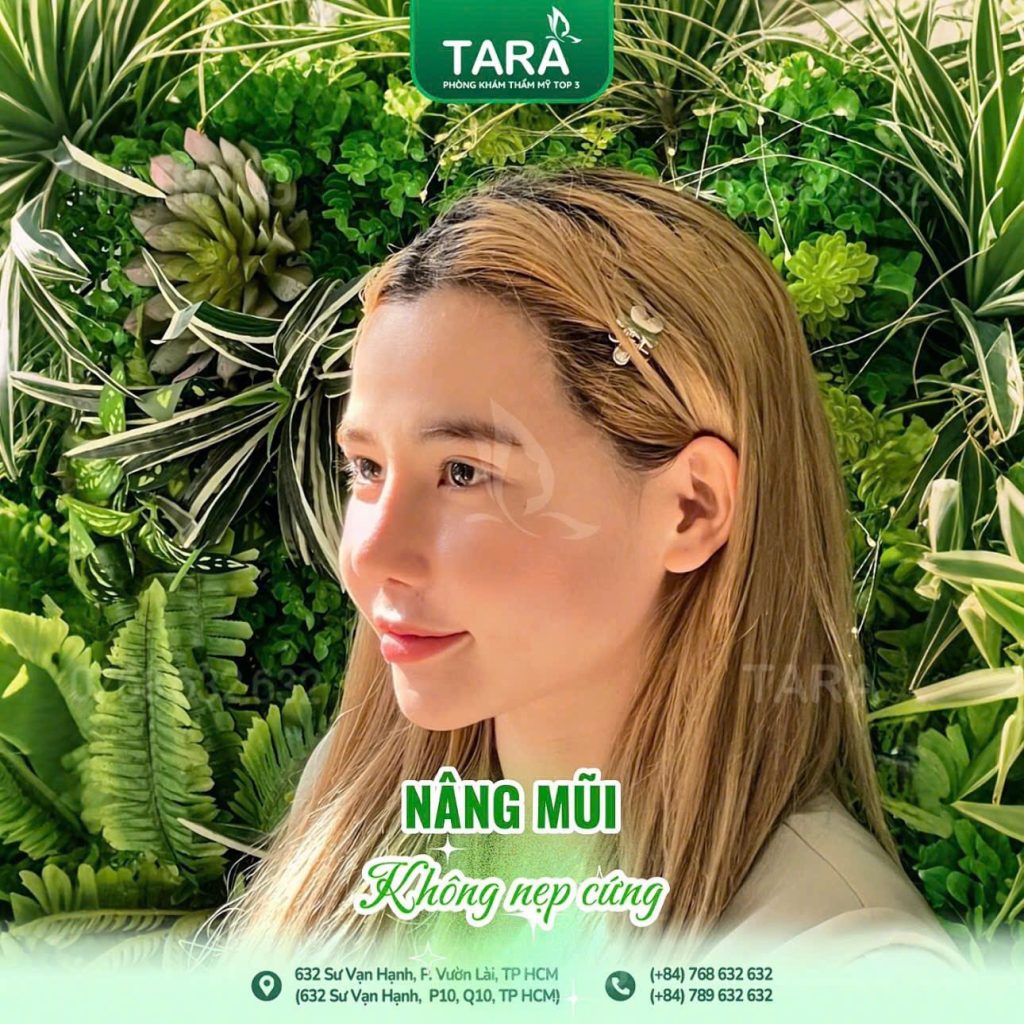 “Nên căng da midface trước hay nâng mũi trước? Bác sĩ giải thích theo từng trường hợp”