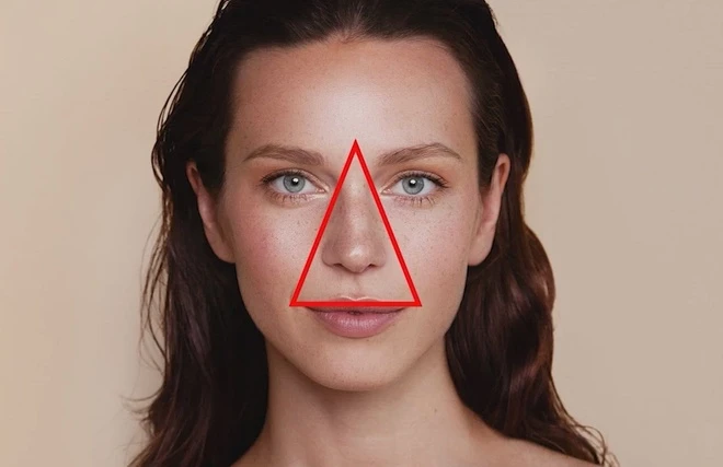 Vì sao chỉ nâng mũi thôi chưa đủ? Góc nhìn về ‘tam giác trẻ trung’: mũi – tầng giữa mặt (midface)– môi