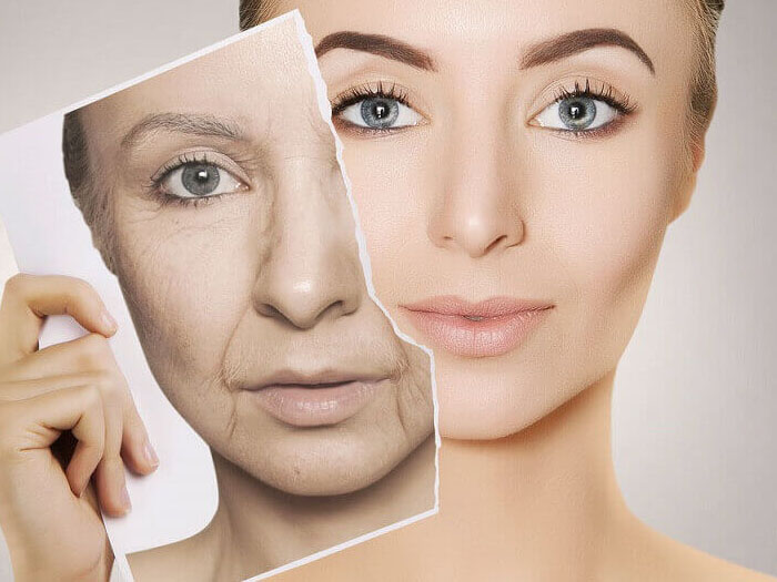 Nên căng da Midface, tiêm filler hay nâng cơ HIFU? Chọn gì cho vùng má giữa bị xệ?